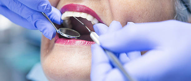 Best Emergency Gum Treatment in New Hampton, IA
